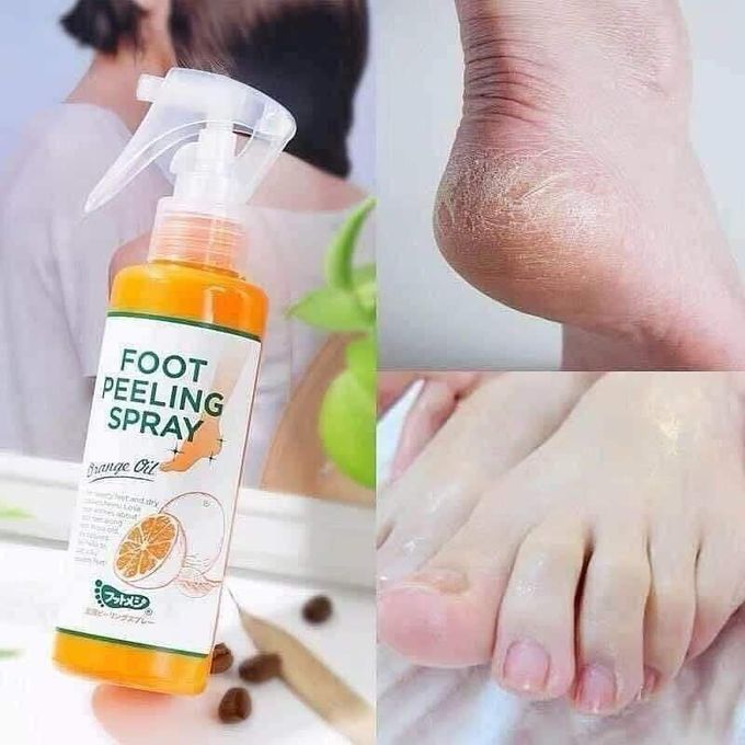 مشاكل القدمين مثل الجفاف والتشقق